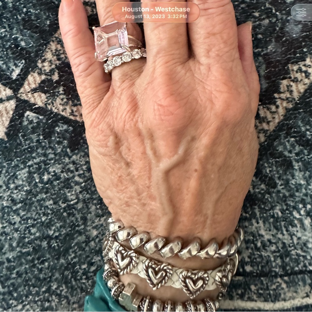 Pretty Rings - Picture 9 of 9